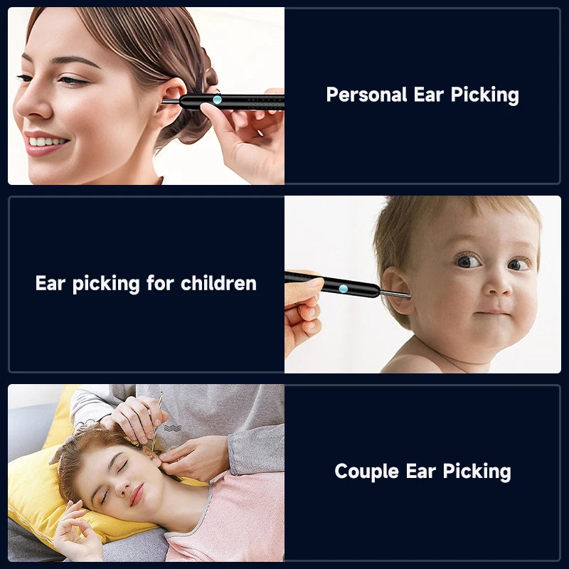Antcam 1080P HD Wireless Ear Cleaning Camera