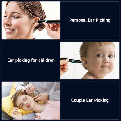 Antcam 1080P HD Wireless Ear Cleaning Camera